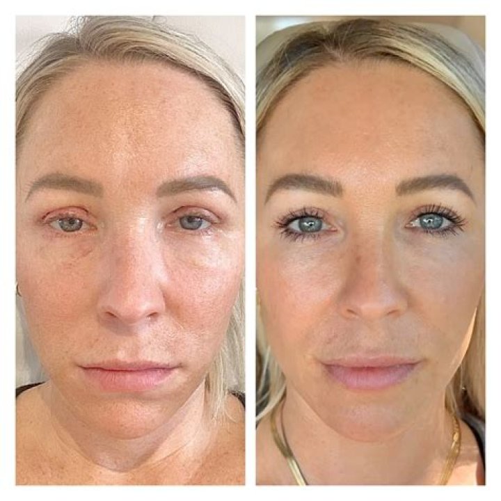 Charlotte Parkes No Makeup 2023 | Before And After Photos